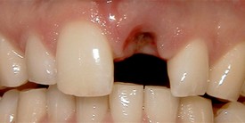 Before